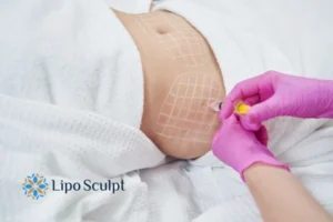 Are The Results From Aqualyx Permanent? 1 Do you want to know how long Aqualyx Datchet results last?