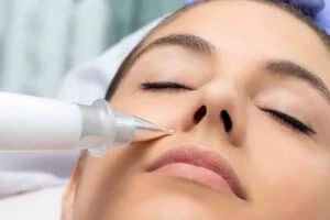 Best Actinic Keratoses Removal 3 Actinic keratoses Datchet solutions - book in today!